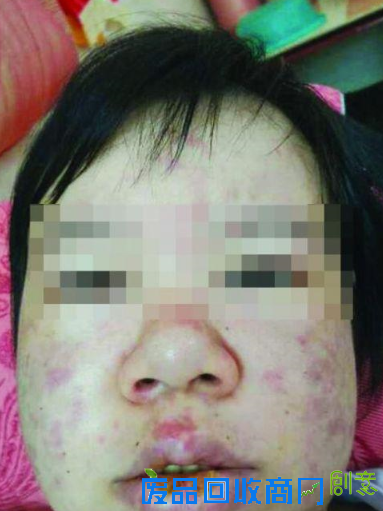 重病女子病房自杀