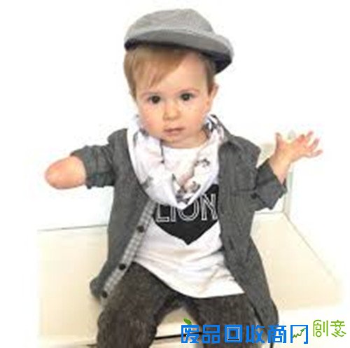 英国“独臂”宝宝天生残疾 时尚可爱获大批粉丝(图)