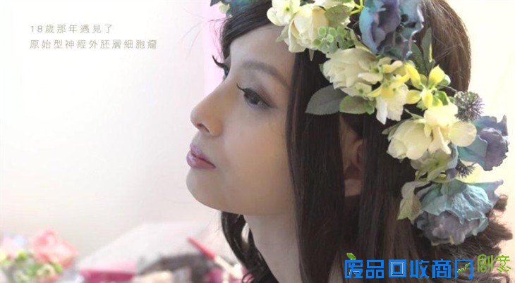 癌症少女圆梦 离世前拍下唯美婚纱照