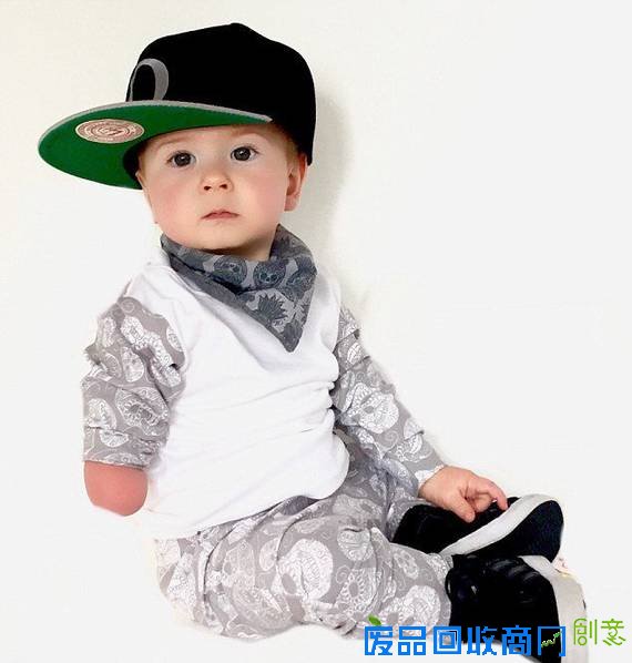 英国“独臂”宝宝天生可爱获大批粉丝