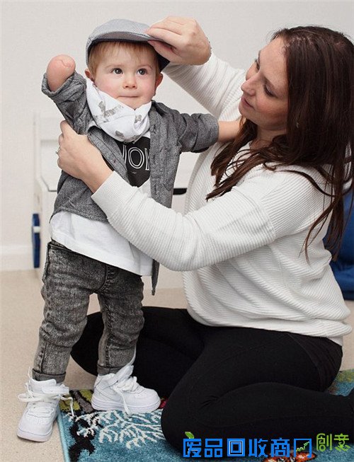 英国“独臂”男婴可爱时尚照片引爆社交网络