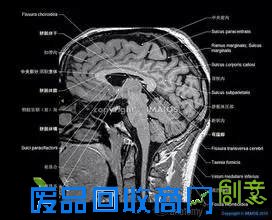 眼睛越大越美?真这样你脑子可能没地放(组图)