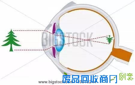 眼睛越大越美?真这样你脑子可能没地放(组图)