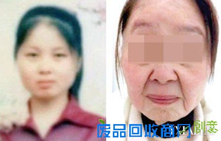 【图】生完孩子皱纹一夜出现 一个“老女人”的忧伤故事