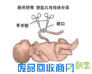 孕妇有以下十四种情况绝对不能去顺产