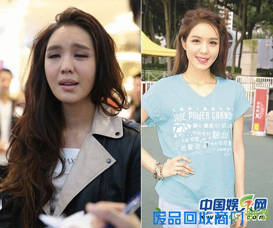 林志玲蔡依林徐若瑄 揭明星的怪病