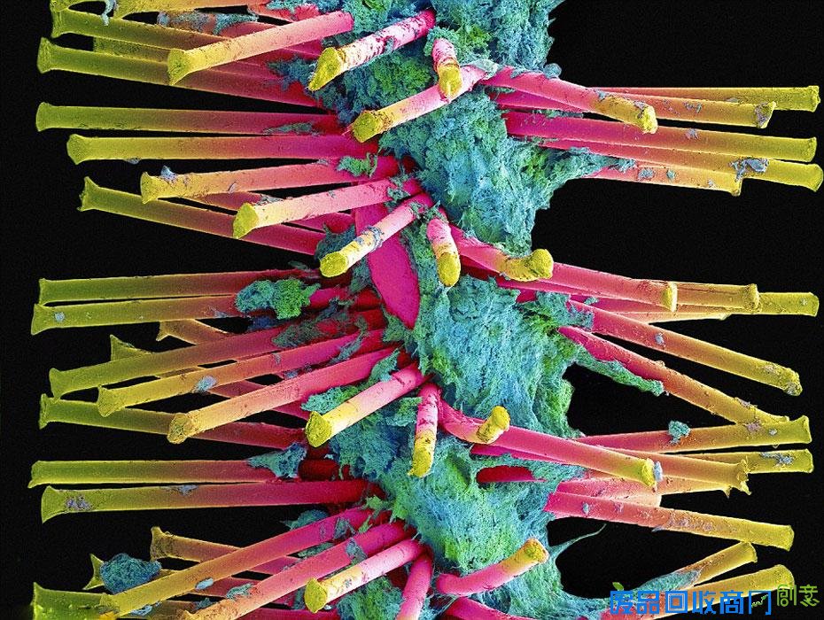 研究发现:“草莓加小苏打”牙齿美白法有害无益