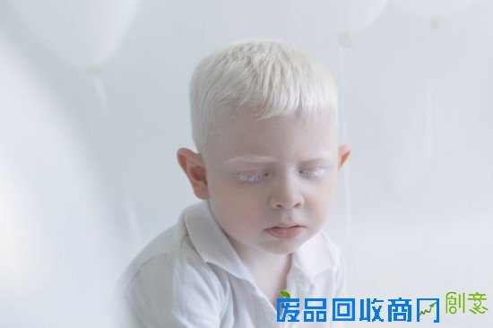 摄影师为白化病人拍唯美大片 他们活着做了一回“天使”