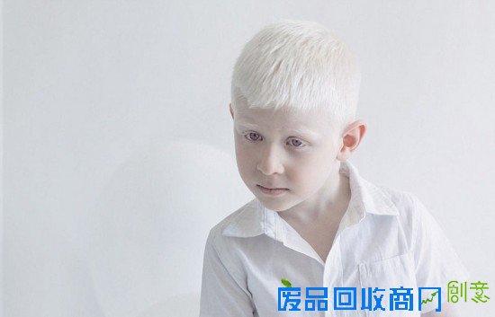 俄摄影师拍摄白化病人 唯美似天使（组图）