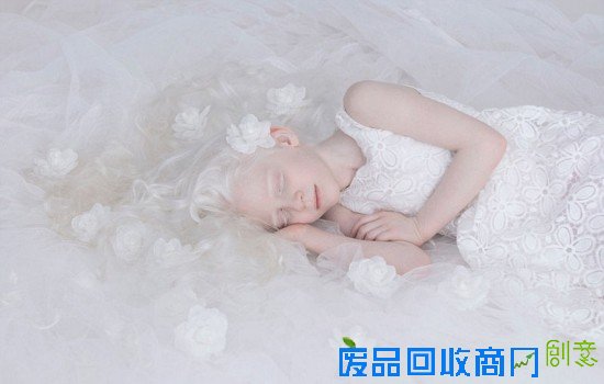 俄摄影师拍摄白化病人 唯美似天使（组图）