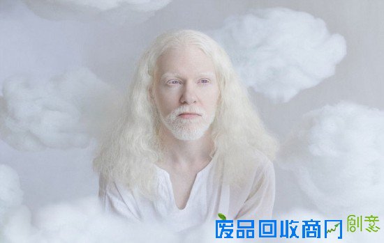 俄摄影师拍摄白化病人 唯美似天使（组图）