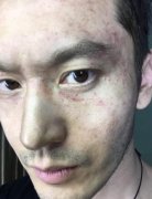 黄晓明倒挂拍戏 脸部充满血丝求妙方(图)