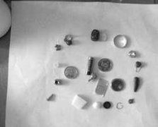 男子与妻吵架后吞镊子打火机 心理专家：是悲伤无助的表现（图）（4）