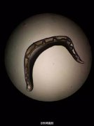 杭州两岁宝宝爱揉眼喊难过 眼中取出两条活虫(图)