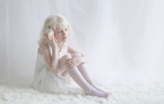 俄摄影师拍摄白化病人 唯美似天使（组图）